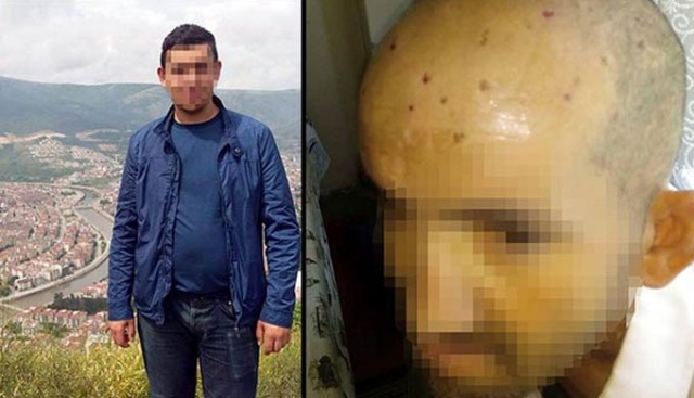 Zihinsel engelli kişinin kafasında sigara söndürdüler. Mahkeme silah saydı